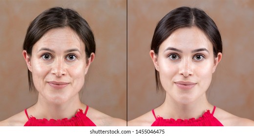 Woman before and after a rejuvenation treatment, from the appear