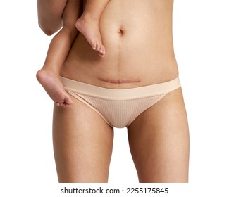 Woman belly with a scar from a cesarean section with her baby's legs on white background                                     