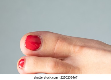Woman big toe with red nail polish and with long hair, concept of epilation and aesthetic treatment. Foot care and pedicure - Shutterstock ID 2250238467
