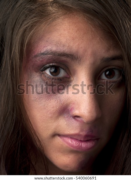 Woman Body Facial Injuries Which Can Stock Photo 540060691 | Shutterstock