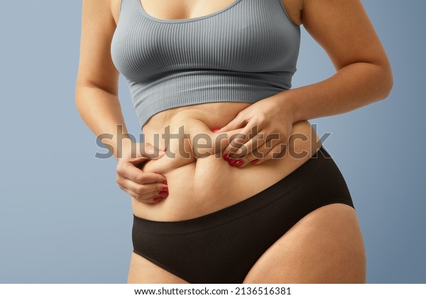 Woman body fat\
belly. Obese woman hands holding excessive tummy fat. Change diet\
lifestyle concept to shape up healthy stomach muscle. Studio\
anonymous shot photo of body\
parts.