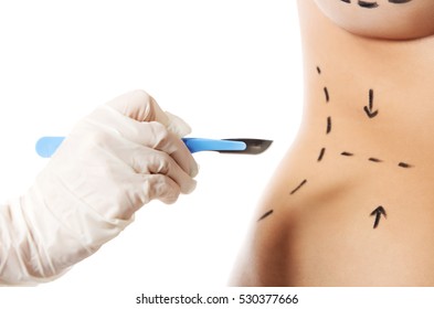 Woman Body Marked Out For Cosmetic Surgery.