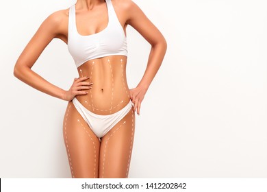 Woman body in perfect form, cosmetic cellulite treatment, plastic surgery and liposuction.