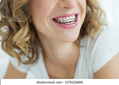 Woman In Braces