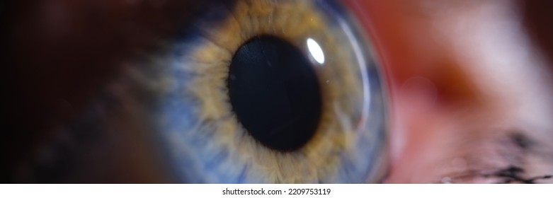 Woman With Bright Blue Eyes On Iris Closeup