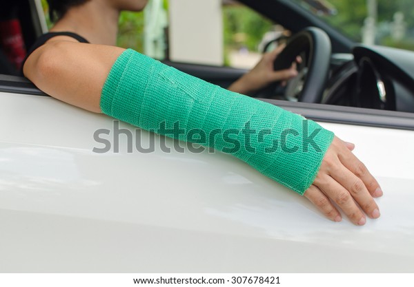 woman with broken hand in green cast sitting in\
car, insurance concept