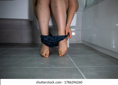 Woman with bruises on her legs using the toilet with her Knickers around her ankles