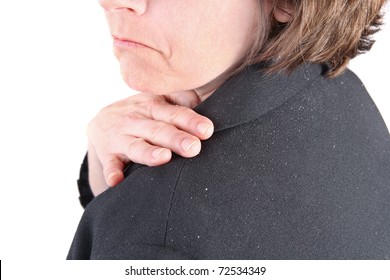 Woman Brushing Dandruff Off Of Her Shoulder