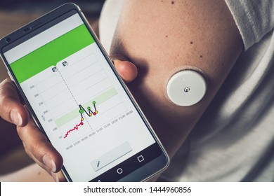 Woman Checking Glucose Level With A Remote Sensor And Mobile Phone, New Technology Sensor Checkup Glucose Levels Without Blood. Diabetes Treatment.