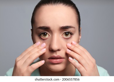 Woman checking her health condition on grey background. Yellow eyes as symptom of problems with liver - Shutterstock ID 2006557856