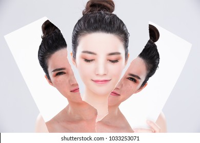 ビフォーアフター 日本人 肌 Images Stock Photos Vectors Shutterstock