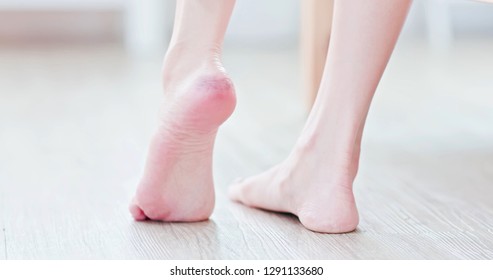 Woman With Crack And Dry Skin On Her Foot Heel At Home