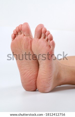 Woman cracked heels with white background, foot healthy concept. Selective focus image.
