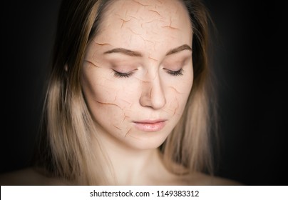 Woman With Cracked Skin As Cosmetic And Dehydration Effect Concept.