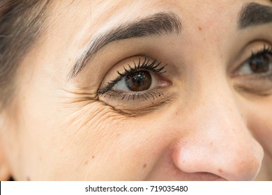 Woman With Crow's Feet In Her Eyes