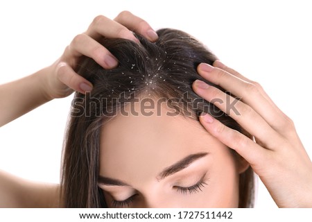 Woman with dandruff in her hair on white background, closeup Foto stock © 
