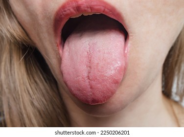 Woman demonstrates her tongue. Close-up - Shutterstock ID 2250206201