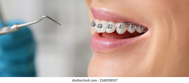 Woman With Dental Braces Visiting Dentist In Clinic, Closeup