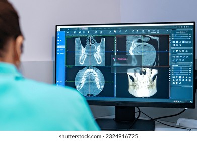 Woman dentist looking at a photo of the 3D tomograph on monitor - Powered by Shutterstock