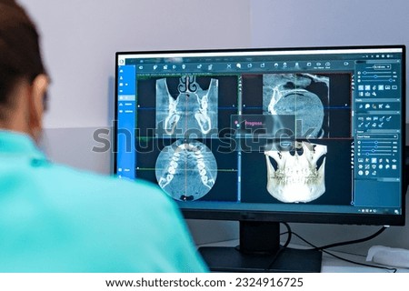 Woman dentist looking at a photo of the 3D tomograph on monitor