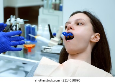 Woman with denture mould impression on upper jaw in dentistry to create a prosthesis. Orthodontist treatment in dentistry, dental prosthodontics prosthetics. Taking impressions to create veneers. - Shutterstock ID 2114058890