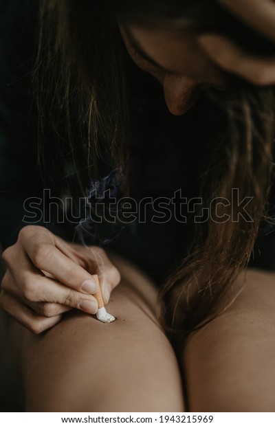 Woman with\
depression hurts herself with a\
cigarette