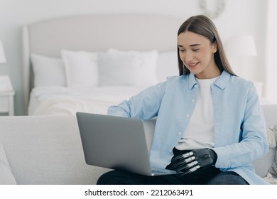 Woman With A Disability With Artificial Arm Limb Works At Laptop At Home Office. Happy Female Student With Disability Learning Online, Using Bionic Hand Prosthesis. Medical High Tech Concept.