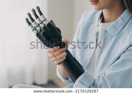 Woman with a disability is disassembling bionic arm prosthesis. Cyber sensor hand has processor chip and buttons. Caucasian girl is amputee adjusting her electronic artificial arm at home.