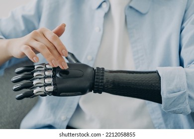 Woman With A Disability Turns On Her Sensory Bionic Hand Prosthesis, Close Up. Female With Disability Touches Artificial Robotic Prosthetic Arm. People With Disabilities And High Tech Medical Care