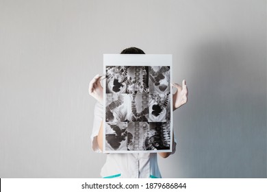 Woman Doctor Checking The Intestine Xray Of Dolichocolon Person