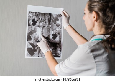 Woman Doctor Checking The Intestine Xray Of Dolichocolon Person