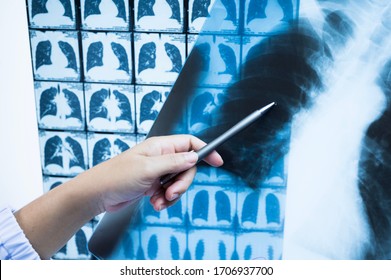 Woman Doctor Compare Patient Chest X-ray And CT Scan Film Before Treatment.Image Lung At Radiology Department In Hospital.Covid-19 Scan Body Xray Test Detection For Covid Virus Epidemic Spread Concept