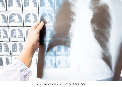 Woman Doctor Compare Patient Chest X-ray And CT Scan Film Before Treatment.Image Lung At Radiology Department In Hospital.Covid-19 Scan Body Xray Test Detection For Covid Virus Epidemic Spread Concept