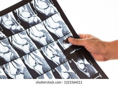 Woman Doctor Hand Holding Patient Bone X-ray Film Before Surgery.Image MRI And CT Scan At Radiology Orthopedic Department In Hospital.Knee Join Xray For Treatment.Selective Focus.