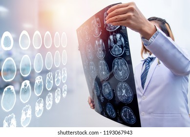 Woman Doctor Holding MRI Film To Diagnosis Injury Area Of Brain With Double Exposure Of Brain CT Scan 