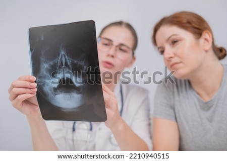 A woman doctor and a patient at the reception are discussing an x-ray of the sinuses.