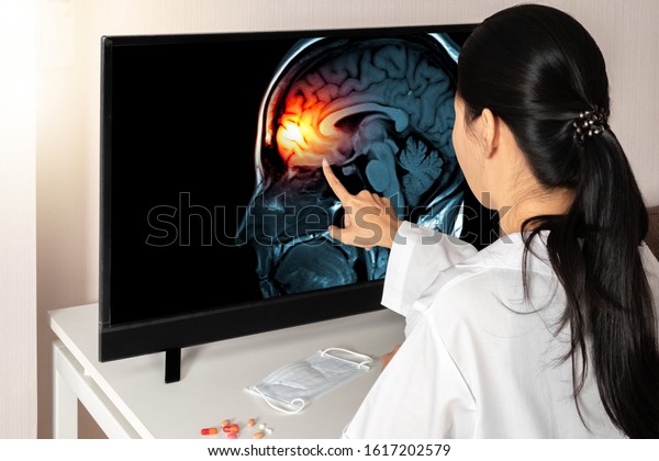 Woman doctor touching a screen of a\
monitor with x-ray of brain and skull skeleton. Headache,\
meningitis and migraine concept. Mask and drugs medicine on the\
desk