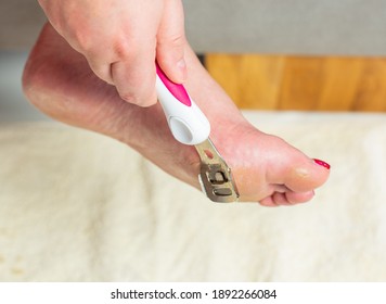 Woman Does Foot Care And Removes The Callus On The Ankle