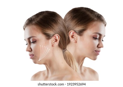 Woman Double Chin Before And After