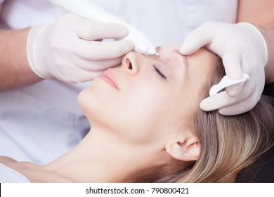 Woman During Wart Removal Above The Eye  Closeup 