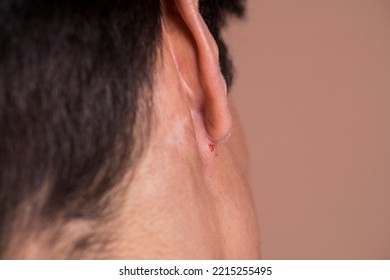 Woman Ear Pain. Problem. Virus. 