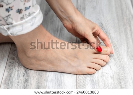 woman examining the horn on her big toe. nail fungus. toenail disease. onychomycosis of nails. yellow toenail. change in nail color. treatment of toenail disease