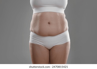Woman with excessive belly fat on grey background, closeup. Overweight problem