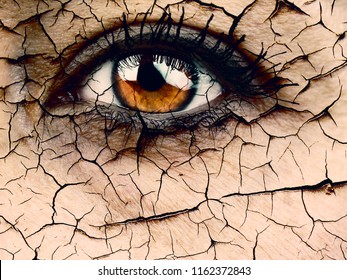 Woman Eye Close Up Dramatic Dehydration Or Aging Concept