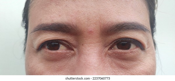 Woman eyes closeup, not clear, yellow eyes, double eyelids, bags under the eyes, wrinkles, thick eyebrows, long eyelashes   - Shutterstock ID 2237060773