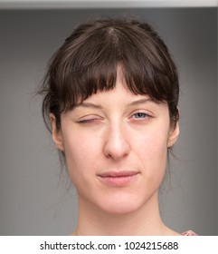 Woman With Facial Hemiparesis