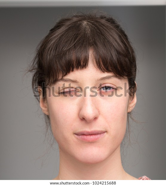 4 Facial Paresthesia Images, Stock Photos & Vectors | Shutterstock