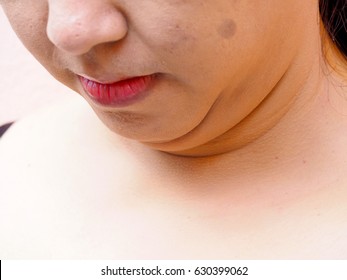 Woman with fat neck(side view), chin fat, fat woman, Beauty concept