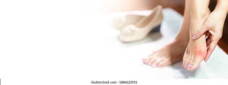 Woman Feet Problem. Banner Of Beautiful Working Woman's Hand Massaging Her Bunion Toes In Bare Feet To Relieve Pain Due To Wearing Pointy And Narrow Shoes. Medical Condition - Bunions (Hallux Valgus).