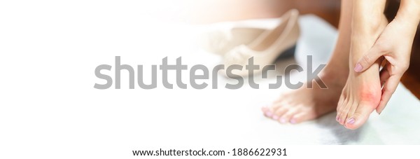 Woman feet problem. Banner of beautiful working\
woman\'s hand massaging her bunion toes in bare feet to relieve pain\
due to wearing pointy and narrow shoes. Medical condition - bunions\
(Hallux valgus).